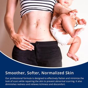 Silicone Scar Gel 30g – Scar Removal Cream for C-Section, Acne, Stretch Marks