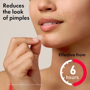 Mighty Patch Original Acne Patches – Blemish Spot Treatment Strips