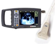 Ultrasound Machine For Pregnancy For Home