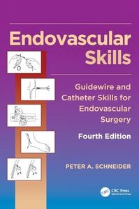 Endovascul