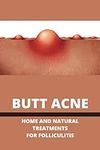 Butt Acne: Home And Natural Treatme