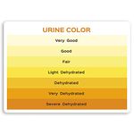 2 x 10cm Urine Color Vinyl Stickers - Medical Nurse Doctor Health Sticker #30065 (10cm Wide)