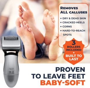 Own Harmony Electric Callus Remover – Rechargeable Foot File