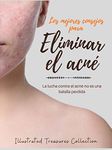 Los mejores consejos para eliminar el Acné: Te enseñaremos diferentes métodos para curar el acné y como corregir las cicatrices físicas y emocionales: ... no es una batalla perdida (Spanish Edition)