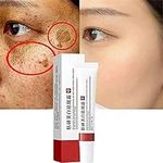 Whitening Freckle Cream,Acne Scar Removal Treatment Cream,Pigmentation Removal Cream for Face,Remove Dark Spots,Moisturizing Removes Facial Melasma Dark Spots Wrinkles Blemishes (1pcs)