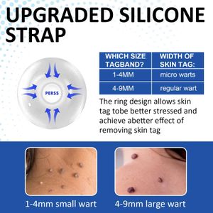 Skin Tag Remover Pen Kit – Safe Home Mole & Wart Removal Tool