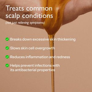 Polytar Scalp Shampoo 150ml – Anti-Dandruff Treatment