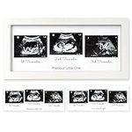 Sonogram Picture Frame - Trio Ultra