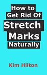 How to Get Rid Of Stretch Marks Naturally