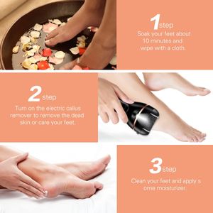 Ratukall Electric Foot File – Rechargeable Callus Remover