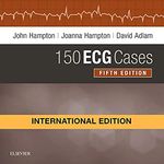 150 ECG Cases, International Edition, 5e