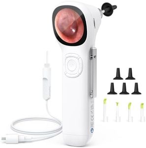 ScopeAround Digital Otoscope With IPS Screen