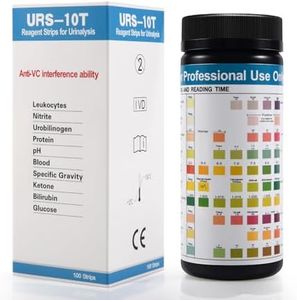 Urinalysis