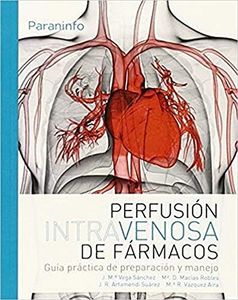 Perfusión intravenosa de fármacos. Guía práctica de preparación y manejo (Salud)