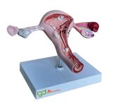 GD ANATOMICALS ® Pathological Uterus Anatomical Model