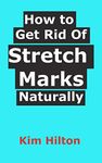 Cream To Get Rid Of Stretch Marks