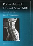 Pocket Atlas of Spinal MRI