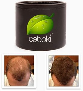 Thinning Hair Solution - All-Natural, Plant-Based Fibers For Fuller, Thicker Appearance. Instantly Covers Bald Spots. Auburn (red/ginger hair). Trial Size, 10-Day Supply