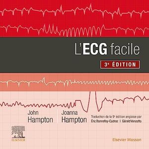 L'ECG faci