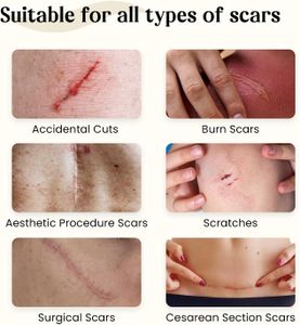 Dermatix Silicone Scar Gel 60g Tube – Scar Management Treatment