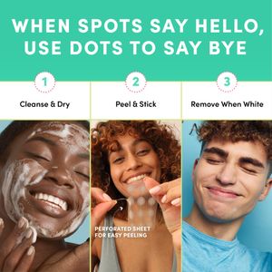 Dots for Spots Acne Patches 60-Pack – Hydrocolloid Spot Treatment