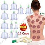12 Cups set Medical Chinese Vacuum Cupping Body Massage Therapy Healthy Suction