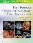 First Trimester Ultrasound Diagnosi