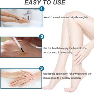 Extra Strength Wart & Corn Remover Gel – Fast Acting for Feet, Hands, 0.67oz