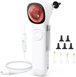 ScopeAround Digital Otoscope with IPS Screen, 720p HD Smart Visual Ear Camera, Ear Scope Otoscope Camera with 6 LED Lights, Ear Wax Removal Tool Camera, Plug & Play