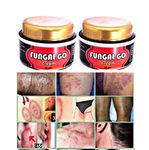 Fungus super cream for Ayurveda fungal herbal infection