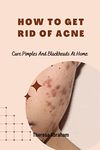 Acne Cures