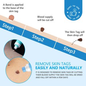 2-in-1 Skin Tag Remover Kit – Easy Home Removal Tool Set