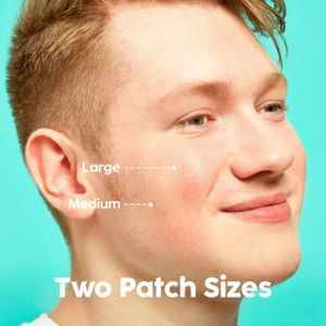 Patch Perfect Hydrocolloid Pimple Patches, 102 Count – Acne Spot Treatment