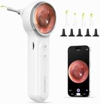 ScopeAround Digital Otoscope with 1.85 in IPS Screen, 1080p FHD Smart Visual Ear Camera, Ear Scope with Gyroscope, Wireless Otoscope with 6 LED Lights, Compatible with Android/iPhone