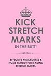 Kick Stretch Marks in the butt! Effective Home remedy for fading stretch marks acquired through weight gain or pregnancy.