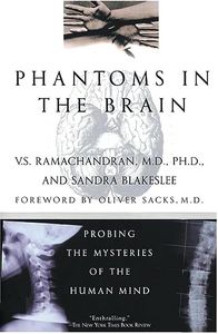 Phantoms in the Brain