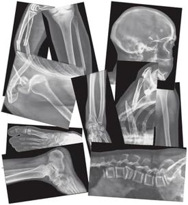 Roylco Broken Bones X-Rays – 15 Realistic Fracture Images for STEM/STEAM Learning, Classroom Anatomy, Health Education, and Labs – Perfect for Teachers, Parents, and Medical Training