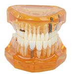 Teeth Model for Teaching Supplies Tooth Brushing Model Orange Color Removable Study Teaching Teeth Model