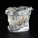 Dental All In One Study Model (Feature - Dental implants, Crown and bridge, Implant-supported bridge, Tooth avulsion, Abfraction Root canal Caries Periapical)