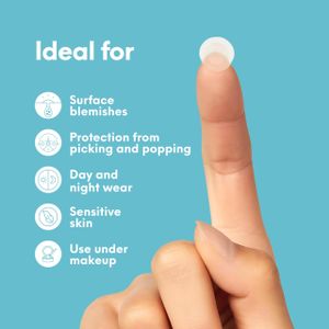 SKIN CHOICE Acne Spot Patches 30-Pack – Hydrocolloid Blemish Treatment