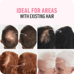 BOLDIFY Hair Fibres Black 56g – Instant Hair Thickening Powder
