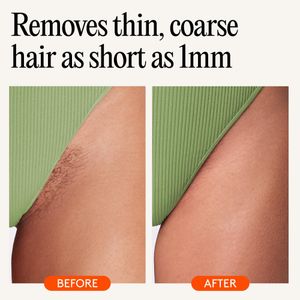 Mylee Professional Waxing Kit – Complete Hair Removal Set