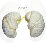 WKM 3D Human Brain Model Structure Life Size Anatomy Removable in 3 parts Features of Brain | Brain Model for Classroom Study Display, Teaching Anatomy | (19x16x13 cm)