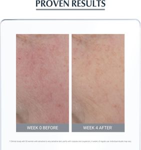 Eucerin AntiRedness Tinted Day Cream SPF 25, 50ml – Redness-Reducing Moisturiser for Sensitive Skin