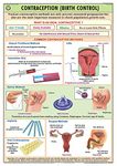 HP31S | TeachingNest | Contraception (Birth Control) Chart 70x100 cm | English | Human Physiology Chart | Synthetic | Wall Sticking [Wall Chart] teachingnest and Human Physiology Charts