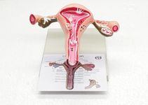 ISKO® Uterus Ovary Model Body Anatomy Replica of Female Reproductive System Organ Anatomical Model with base showing the common Pathologies for Doctors Office Educational Tool