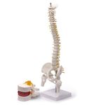 Myaskro Lumbar Spine Herniation Disc Model With 45cm Tall Human Spine Model (Premium Quality)