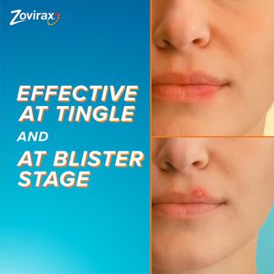 Zovirax Cold Sore Cream 2g – Antiviral Treatment