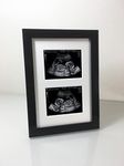 Twin 2 Aperture Ultrasound Sonogram Baby Scan Photo Frame, White