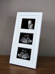 SignatureFrames Baby Scan Photo Frame. Triple ultrasound scan frame in gloss white.